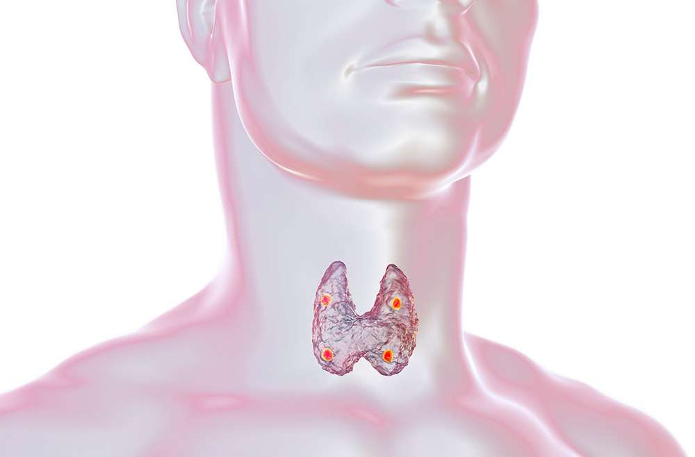 What Is a Thyroidectomy Surgery and Why Merida Is Your Best Option to Realize it?