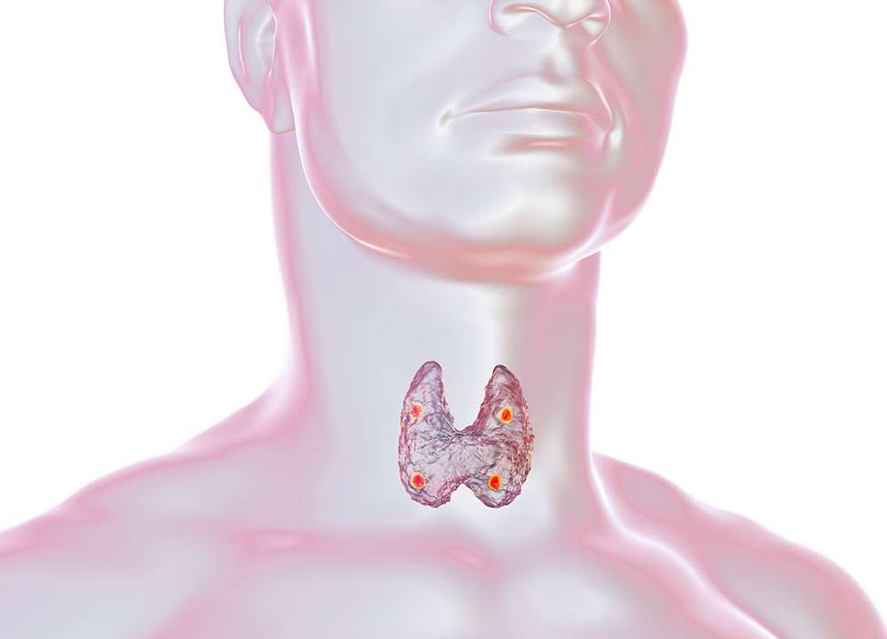 What Is a Thyroidectomy Surgery and Why Merida Is Your Best Option to Realize it?